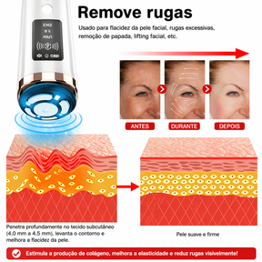 Massagem Facial - Microcorrente para Rejuvenescimento da Pele e Antienvelhecimento