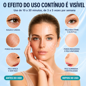 Máscara Facial LED Rejuvenescedora Portátil