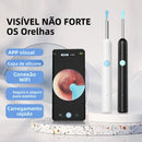 Removedor de Cera de Ouvido com Câmera