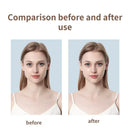 Fita invisível - remoção de rugas, curativo para absorção de acnes, adesivo anti envelhecimento