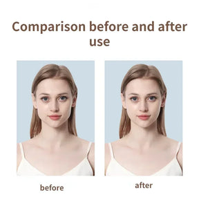 Fita invisível - remoção de rugas, curativo para absorção de acnes, adesivo anti envelhecimento