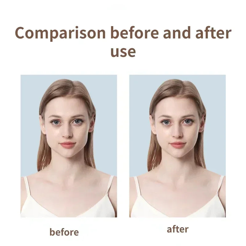 Fita invisível - remoção de rugas, curativo para absorção de acnes, adesivo anti envelhecimento